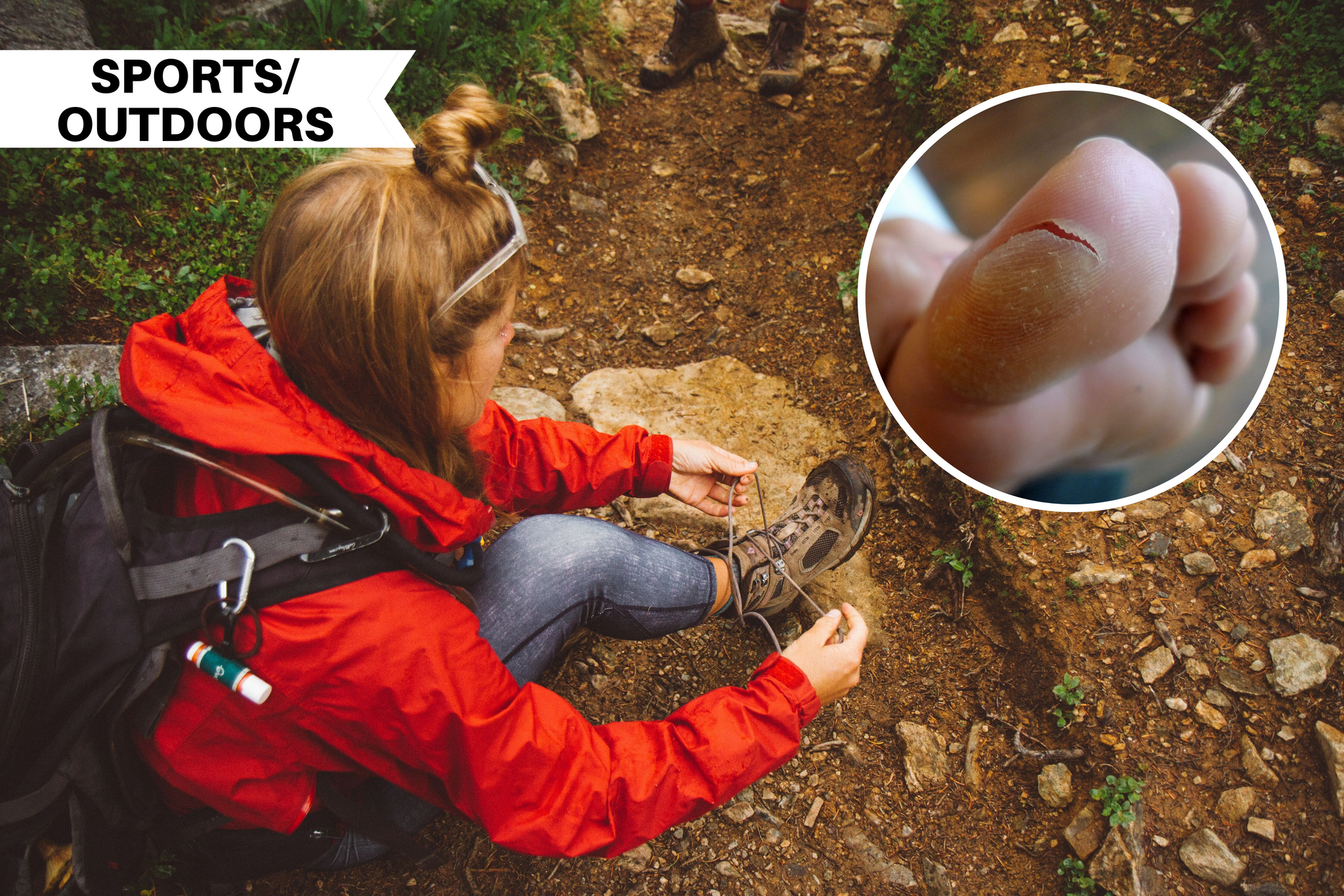 Treating, Avoiding, and Dealing with Blisters on a Hike - Illumiseen